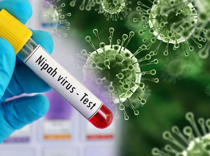 නිපා වෛරසය පිළිබඳ ජාතික සූදානම වහා ශක්තිමත් කළ යුතුයි