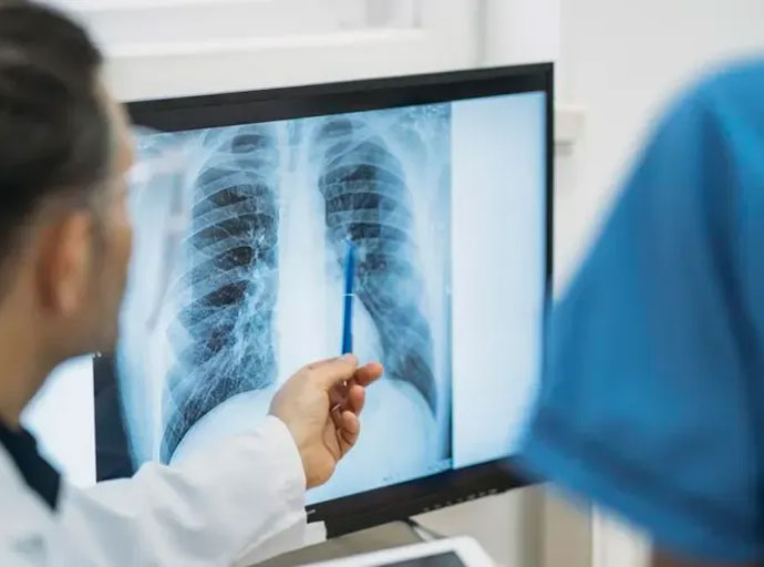 රජයේ විකිරණ විද්‍යා තාක්ෂණවේදීන්ගේ සංගමය වෙතින් නියෝජ්‍ය සෞඛ්‍ය අමාත්‍යවරයා වෙත කඩිනම් ලිපියක්