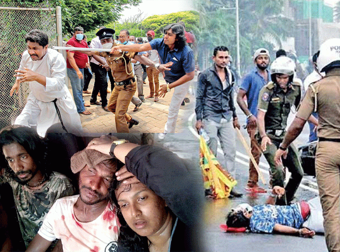 තුවාල ලත් අරගලකරුවන් 39දෙනකු ගේ වාර්තා අධිකරණයට
