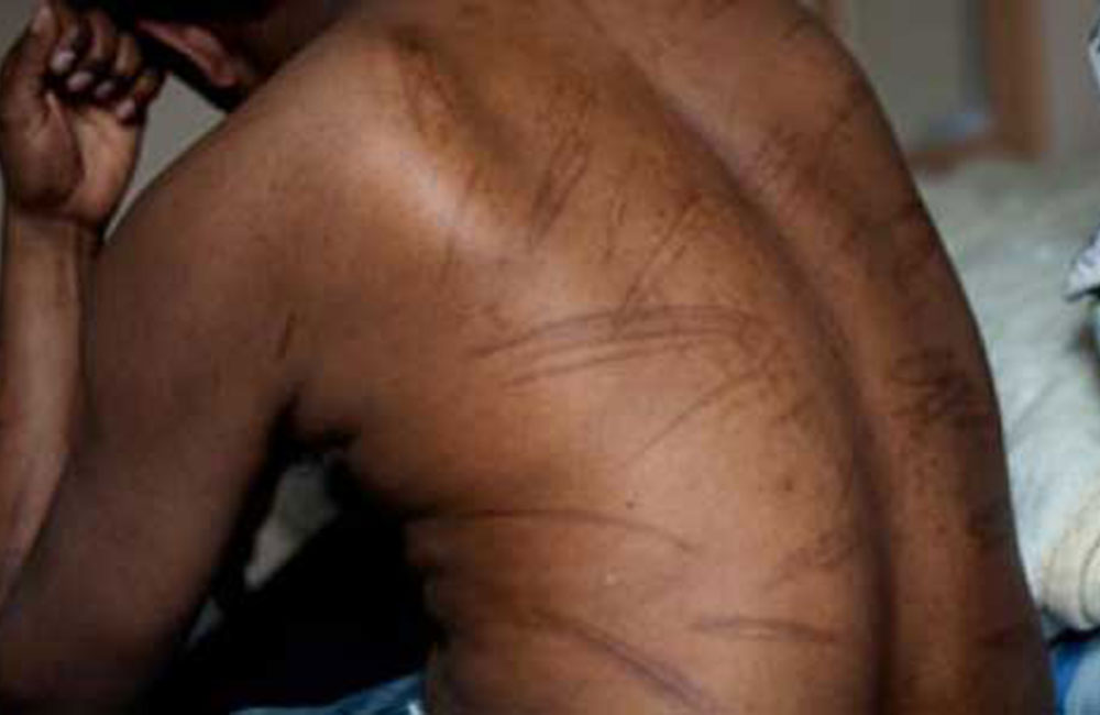 පොලිසියට එරෙහිව වධ හිංසා චෝදනා !