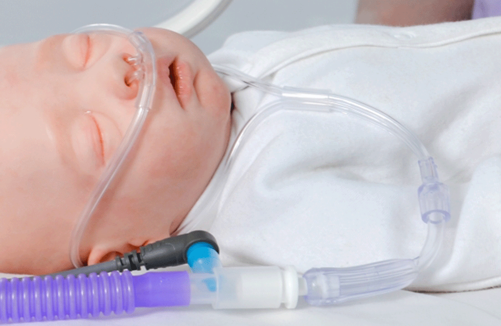 දකුණේ උණ මඩින්න : ‘හයිෆො ඔක්සිජන්’ යන්ත්‍ර යවයි