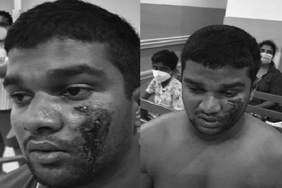 මිගාරට ගුටි දීම : විමර්ශන පෑලියගොඩ පොලිසියෙන් ඉවතට !